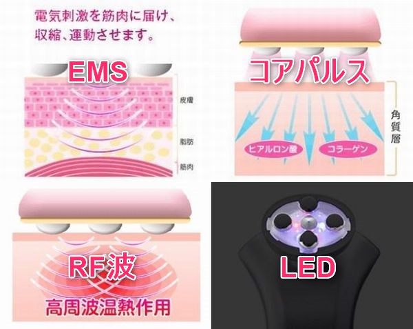 1台4役でエイジングケアの効果が実感できるララルーチュRF美顔器