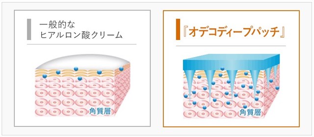 オデコディープパッチのマイクロニードルでヒアルロン酸を角質層まで届ける