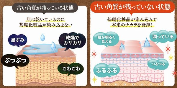 ぽろぽろとれる杏ジェルの角質ケア効果